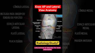 Knee AP and lateral view Anatomy radiology study kneepain shorts medical xray xrays viral [upl. by Jaddan371]