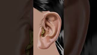 asmr Itchy amp Smelly Ear Stone Removal animation beauty ear [upl. by Zetneuq]