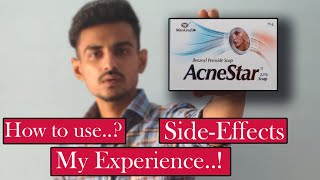 Acnestar Soap  Acne transformation with Acnestar soap Benzoyl peroxide 25 [upl. by Latimer247]