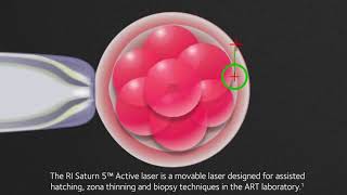 RI Saturn 5™ Active laser [upl. by Aubrette]