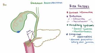 Gallbladder cancer adenocarcinoma causes symptoms amp pathology [upl. by Narmis]