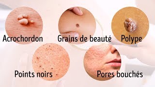 8 Maladies Graves Que Notre Peau Nous Signale [upl. by Belinda]