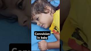 Convulsion in baby nursing baby convulsion seizures [upl. by Dorelle364]