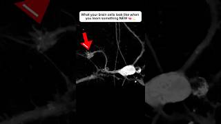 Brain cell restructures itself after forming a new connection neuroplasticity neuroscience brain [upl. by Dolores]