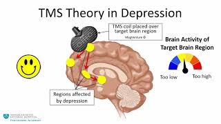 Transcranial Magnetic Stimulation A New Treatment Approach for Psychiatric Disorders [upl. by Eittel]