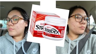 TRYING STRIDEX FOR A WEEK  MY ACNE JOURNEY [upl. by Kahler]