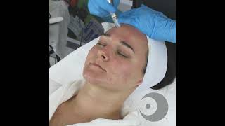 NANO Infusion  Oxygen Infusion with Skin Scrubber Technique Video [upl. by Ilarrold]