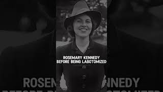 Rosemary Kennedy after being lobotomized rosemarykrnnedy kennedy history viralshorts [upl. by Musetta519]