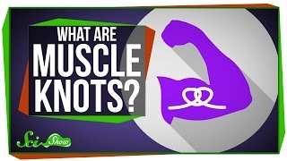 What Are Muscle Knots [upl. by Johnny279]