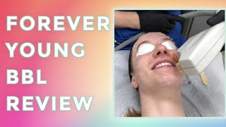 FOREVER YOUNG BBL Review amp Results  Compass Dermatology Toronto [upl. by Jessalin619]