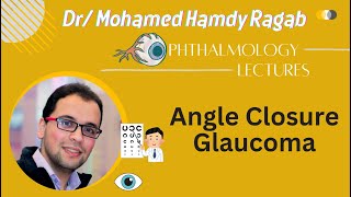 Glaucoma 5 Angle Closure Glaucoma [upl. by Hoj806]