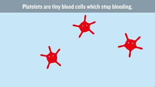 What causes DVT and how can we stop it [upl. by Laith250]