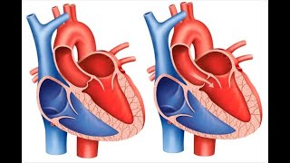 ESTENOSIS AORTICA Medicina Interna [upl. by Neelia]