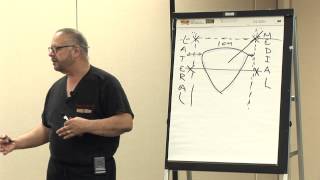 6 Intra Articulate Injection Points of the Knee by Dr Ernest Roman  Empire Medical Training [upl. by Tepper]