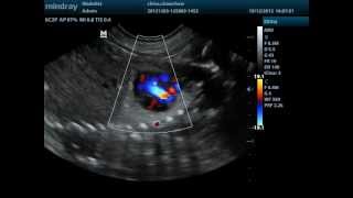 Doppler cardiaco fetal canino [upl. by Gnivri]