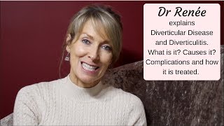 Diverticular Disease  what it is and what are the many complications [upl. by Kotta]