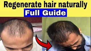 Regrow your hair naturally  regenerate hair naturally  Naye baal ugaye naturally [upl. by Tawsha]