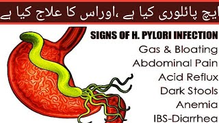 Helicobacter Pylori Infection Causes Signs and Symptoms Diagnosis and Treatment [upl. by Nreval64]