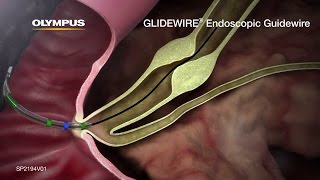 GLIDEWIRE Endoscopic Hydrophilic Coated Guidewire Animation [upl. by Mcnully348]