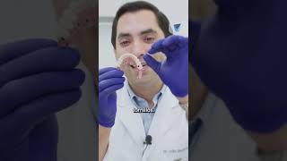 🦷 maxilar atrofiado implantes dentales que cambian vidas ✨ saluddental dentist [upl. by Llehsam]