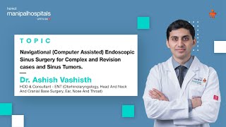 Navigational Endoscopic Sinus Surgery  Dr Ashish Vashishth  Manipal Hospital Delhi [upl. by Bj]