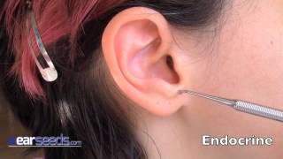 Endocrine Auriculotherapy Ear Point [upl. by Karole]