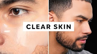 How To Get Clear Skin Only 3 Steps [upl. by Evette528]