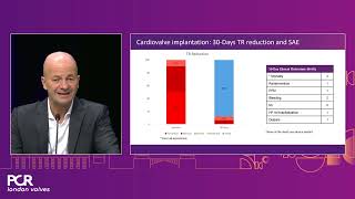 Tricuspid transcatheter valve replacement Cardiovalve keeps things in motion  PCR London Valves [upl. by Melonie]