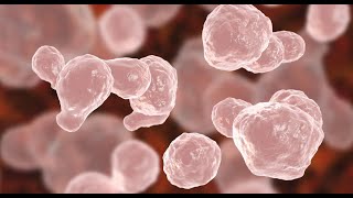 Cryptococcus Neoformans Infection [upl. by Thurlow]