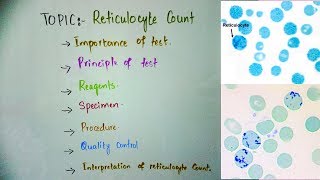 Reticulocyte count principleprocedure and importance in Hindi Urdu and English [upl. by Cressi376]