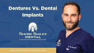 Understanding Denture Options vs Dental Implants A Comprehensive Comparison [upl. by Guy353]