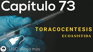 Capítulo 73 Toracocentesis Ecoasistida [upl. by Bohman]