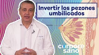 ¿Es posible invertir los pezones umbilicados Corpore Sano [upl. by Ledda]