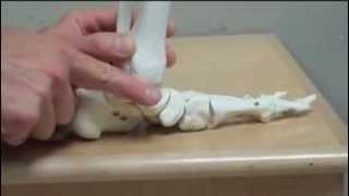 Posterior tibialis dysfunction  Foot Orthotics [upl. by Ginzburg]