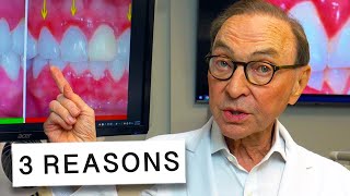 3 Reasons Your Gums Are Inflamed and How to Treat at Home 🦷🔥 [upl. by Vigen]