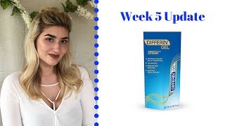 Differin Gel Retinoid Treatment  Week 5 Update [upl. by Friede]