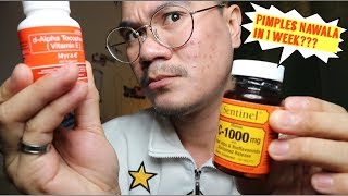 MYRA E 400 EFFECTIVE NGA BA 1 WEEK PRODUCT REVIEW  Dennis Vlog 51 [upl. by Caye]