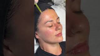 BioRePeel Peeling Mit Liebe zum Detail Kosmetiksalon Berlin 🌿 skincare shortsvideo biorepeel [upl. by Emaj]