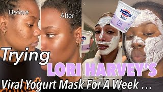 USING GREEK YOGURT AS A MASK On My Face For 5 DAYS [upl. by Tonina]