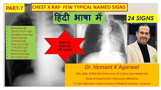 Chest X Ray7 Typical Named Sign हिंदी में Pulmonary Radiology NEETSS Pulmonary Med Hemant [upl. by Nil]