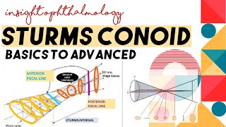 STURMS CONOID  APPLICATIONS AND CONCEPT  Types of astigmatism through sturms conoid [upl. by Afaw]