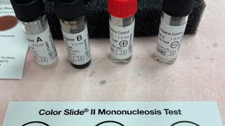 The Kissing Disease Infectious Mononucleosis test medtech medtechstudent foryou educational [upl. by Ayisan]