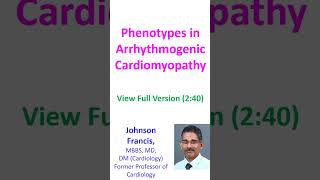 Phenotypes in Arrhythmogenic Cardiomyopathy [upl. by Coit]