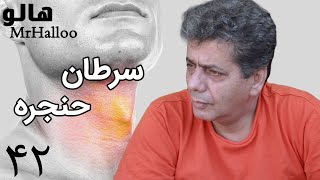 MrHalloo  Saratane Hanjere  هالو  سرطان حنجره [upl. by Edbert20]