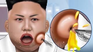 ASMR Facial care for Kim JongUn  Skincare Animation  Removal Ingrown Hair Sebum Shaving [upl. by Akemat]