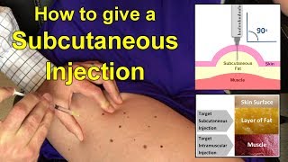 How to Give a Subcutaneous Injection Video [upl. by Ashford]