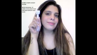 DERMA STAMPYAY OR NAY nonsponsoredreview honestreview hairgrowth microneedling skincare [upl. by Hahnert]