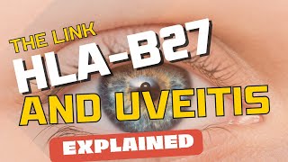 The Link Between HLA B27 and Uveitis Explained [upl. by Roseanna145]