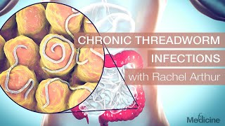 Chronic Threadworm Infections with Rachel Arthur [upl. by Notniuqal]