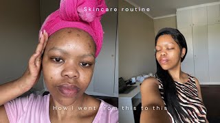 skincare  How to remove dark spots and blemishes with only 4 products [upl. by Dnalyaw875]